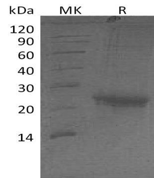 Human CD111/Nectin Recombinant Protein (RPES2271)