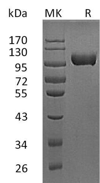 Mouse MMP-9 Recombinant Protein (RPES2274)