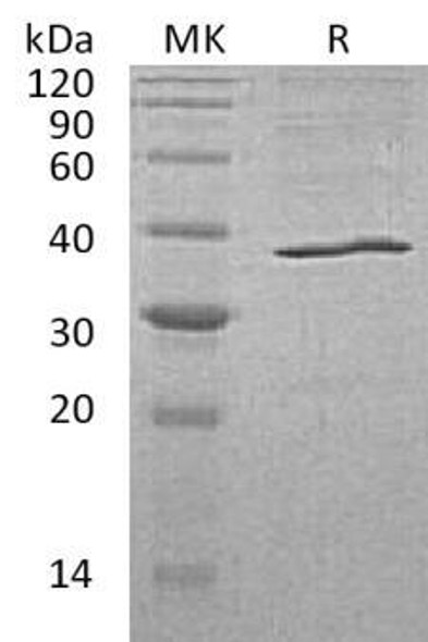 Human AKR1C3 Recombinant Protein (RPES2287)