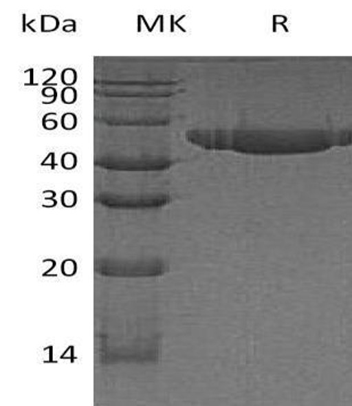 Human CD112/Nectin-2 Recombinant Protein (RPES2290)