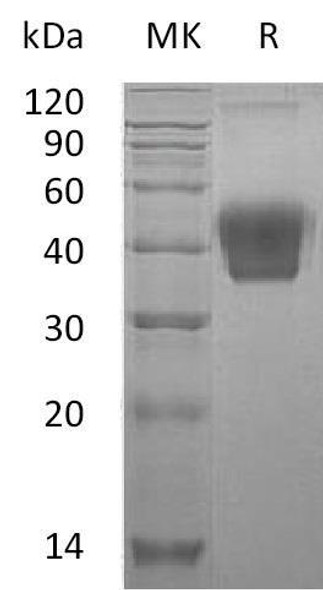 Mouse M-CSF/CSF1 Recombinant Protein (RPES2293)