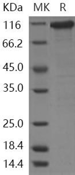 Human Beta-Catenin/CTNNB1 Recombinant Protein (RPES2302)