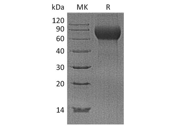 Human Hemopexin/HPX Recombinant Protein (RPES2319)
