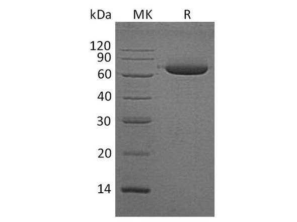 Alkaline Phosphatase/ALPL Recombinant Protein (RPES2329)