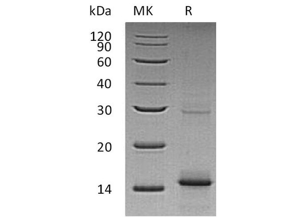 Human GDF5/BMP4 Recombinant Protein (RPES2340)