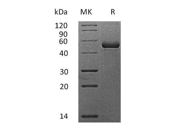 Mouse APRIL/TNFSF13 Recombinant Protein (RPES2341)