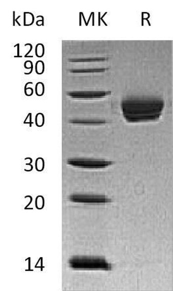 Human Dipeptidase 1/DPEP1 Recombinant Protein (RPES2375)