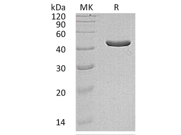 Human IDH1 Recombinant Protein (RPES2385)