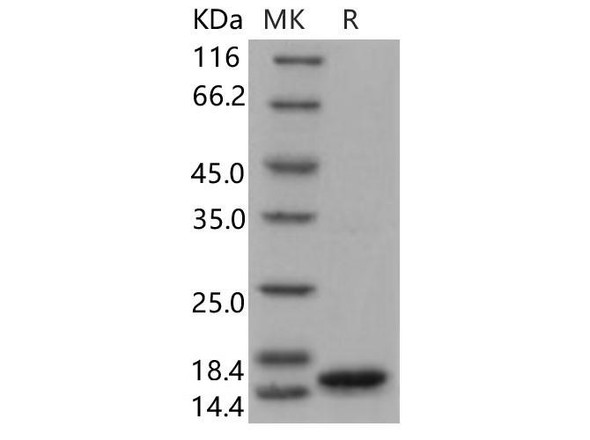 Human FABP5 Recombinant Protein (RPES2388)