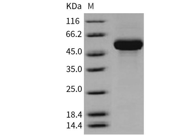 Human CD131/CSF2RB Recombinant Protein (RPES2389)