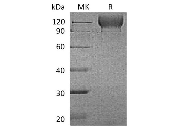 Mouse P-selectin/CD62P Recombinant Protein (RPES2408)