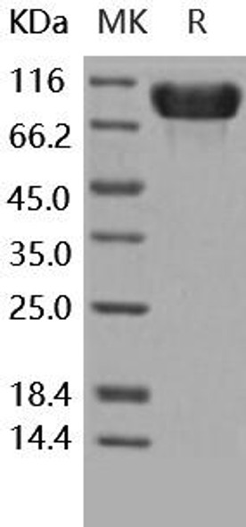 Human Fibronectin/FN Recombinant Protein (RPES2409)