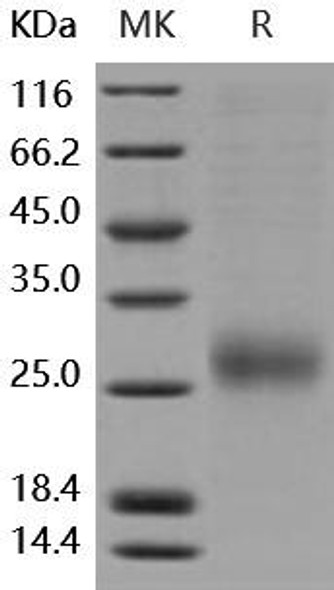 Human ALK/ACVRL1 Recombinant Protein (RPES2413)
