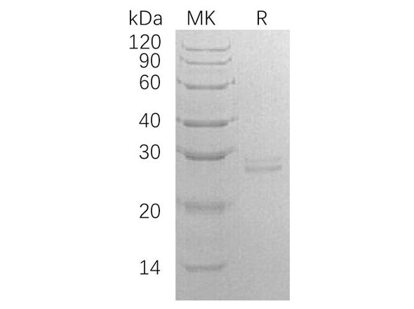 Human RPE Recombinant Protein (RPES2428)