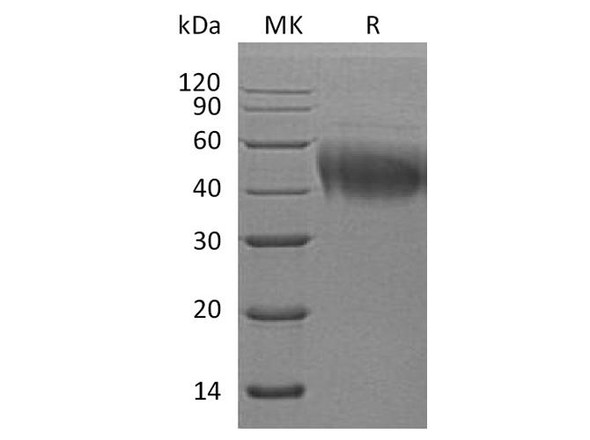 Human IL4RA/CD124 Recombinant Protein (RPES2442)