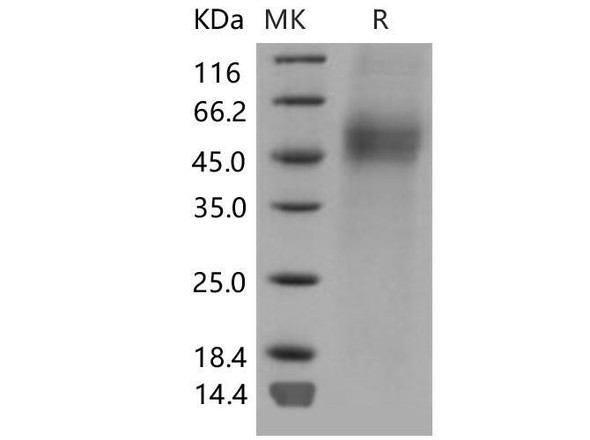 Mouse CD19/Leu2 Recombinant Protein (RPES2445)