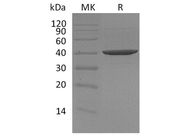 DNA Polymerase Beta/POLB Recombinant Protein (RPES2462)