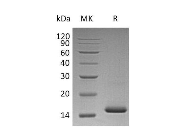 Human VEGF-A/VEGF121 Recombinant Protein  (RPES2485)