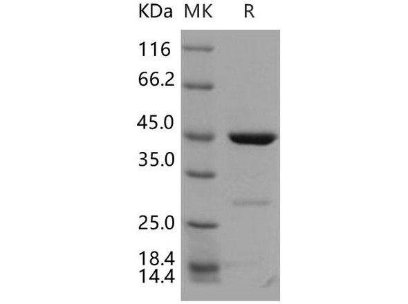 Human CDKN2D/p19ink4d Recombinant Protein (RPES2494)