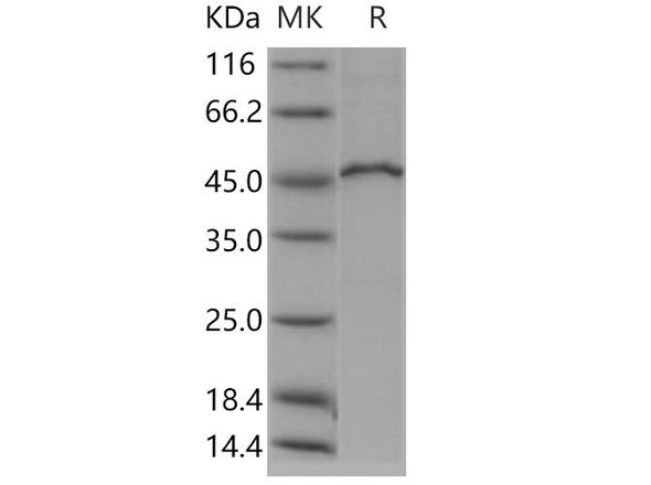 Human MVK/Mevalonate kinase Recombinant Protein (RPES2537)