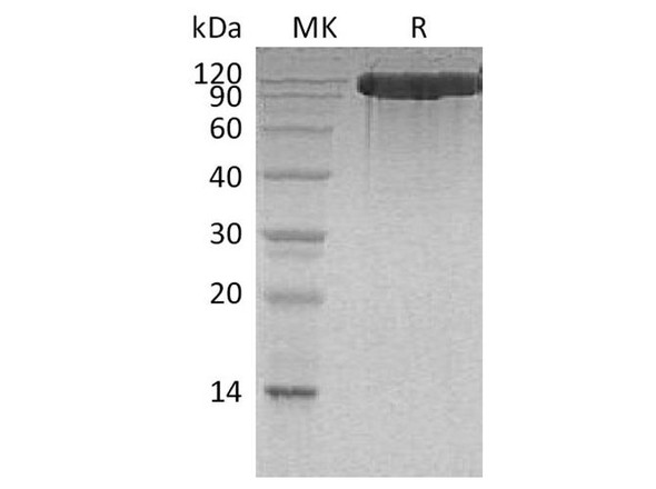Human ACE2 Recombinant Protein (RPES2538)