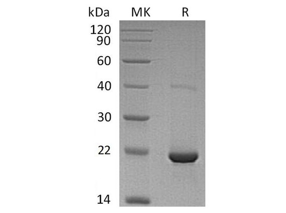 Human dUTPase Recombinant Protein (RPES2560)