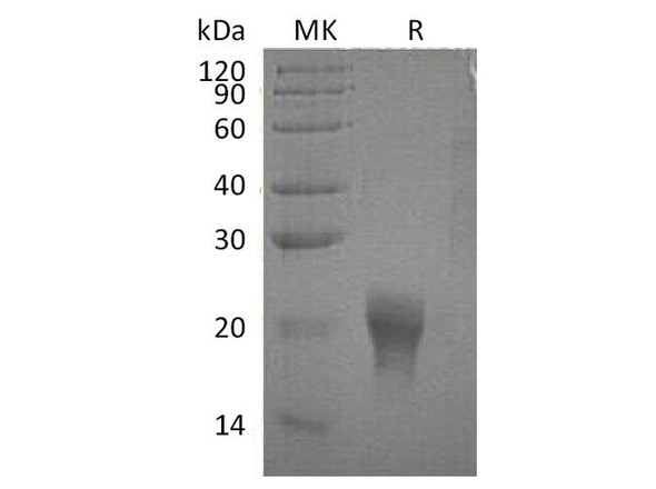 Human Interleukin-5/IL-5 Recombinant Protein (RPES2561)