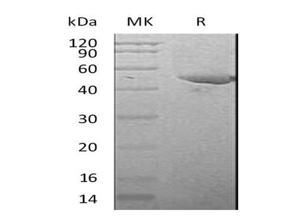 Mouse Serpin E1/PAI Recombinant Protein (RPES2586)