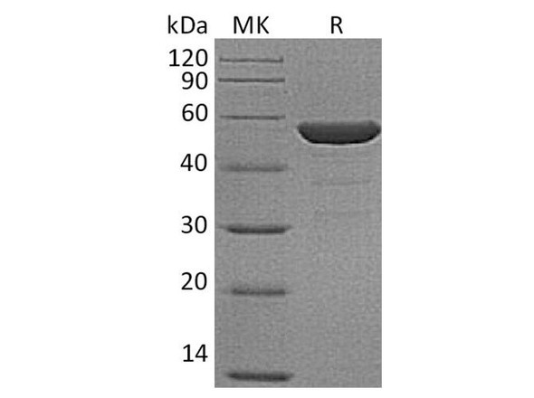 Human NSE/ENO2 Recombinant Protein (RPES2591)