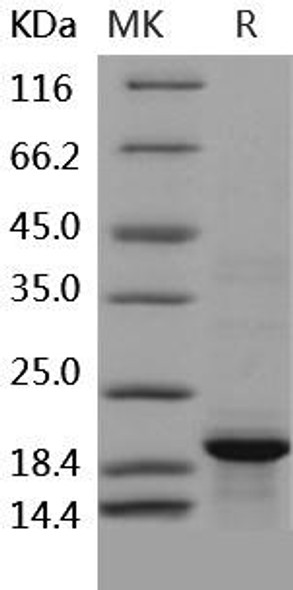 Human BLyS/TNFSF13B/BAFF Recombinant Protein (RPES2597)