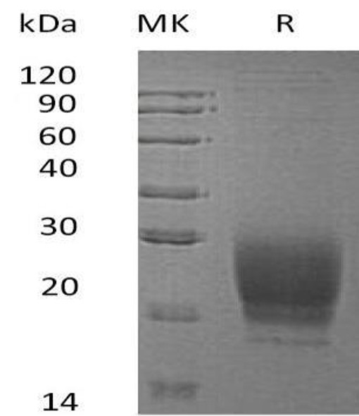 Human PRND Recombinant Protein (RPES2605)