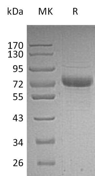 Human Vitronectin/VTN Recombinant Protein (RPES2626)