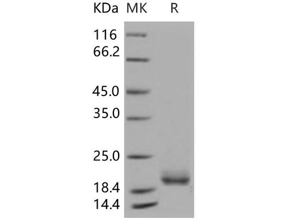 LAIR2/CD306 Recombinant Protein, Low Endotoxin (RPES2641)