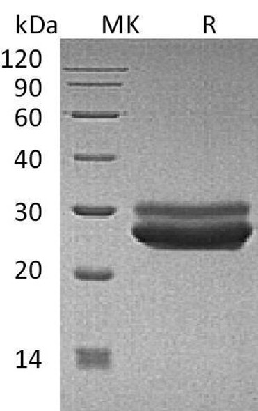 Human Prolactin/PRL Recombinant Protein (RPES2645)