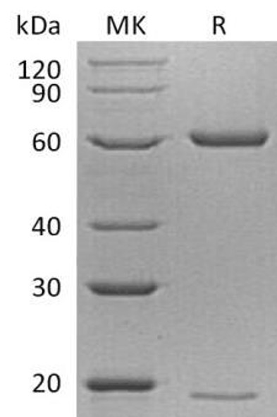 Mouse PCSK9/NARC1 Recombinant Protein (RPES2648)