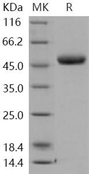 Human Chitotriosidase/CHIT1 Recombinant Protein (RPES2657)