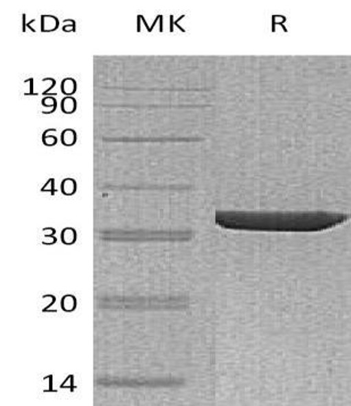 Human Annexin A3/ANXA3 Recombinant Protein (RPES2685)