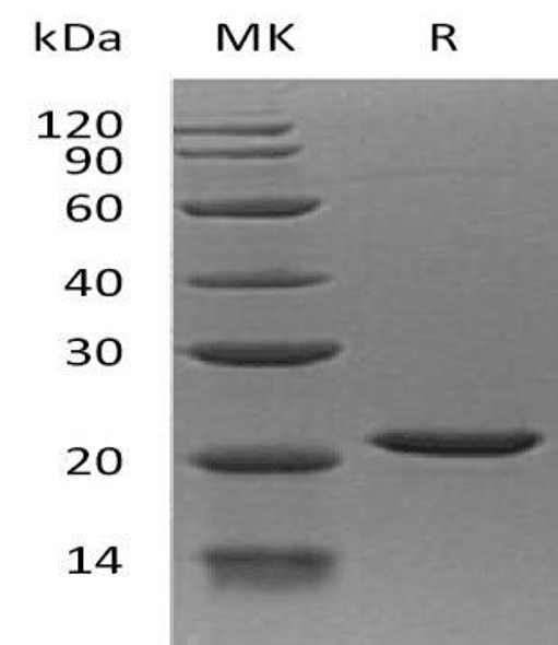 Human EIF1AX Recombinant Protein (RPES2686)