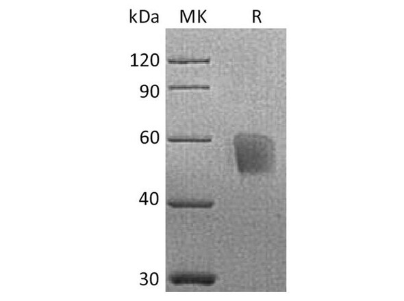 Cynomolgus CD3d/CD3 delta Recombinant Protein (RPES2696)