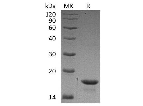 Human 4E-BP1/EIF4EBP1 Recombinant Protein (RPES2707)