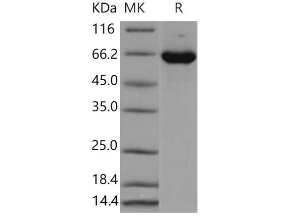 Mouse ERK2/MAPK1/MAPK2 Recombinant Protein (RPES2711)