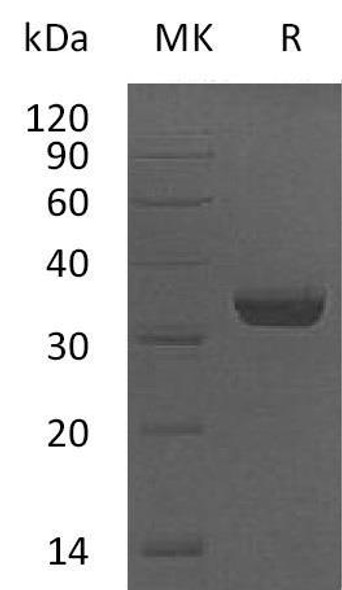 Human LMAN2/VIP36 Recombinant Protein (RPES2719)