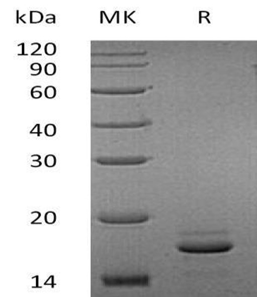 Human EIF4EBP2 Recombinant Protein (RPES2728)