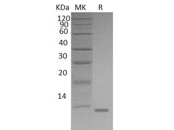 Mouse S100A8/CAGA Recombinant Protein (RPES2733)
