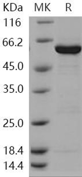 Human GALK1/Galactokinase Recombinant Protein (RPES2745)