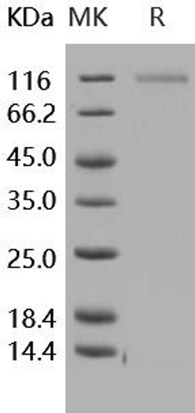 Human CD31/PECAM1 Recombinant Protein (RPES2759)