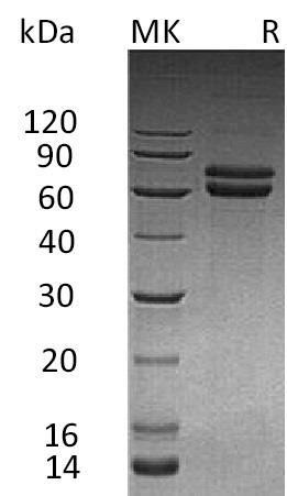 Human JAM-B/CD322 Recombinant Protein (RPES2768)