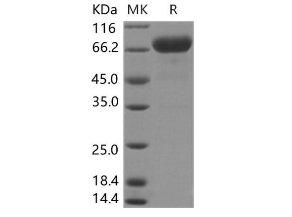 Human Interleukin2/IL2 Recombinant Protein (RPES2777)