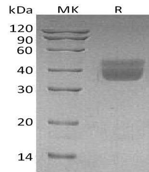 Human Kallikrein 1/KLK1 Recombinant Protein (RPES2787)