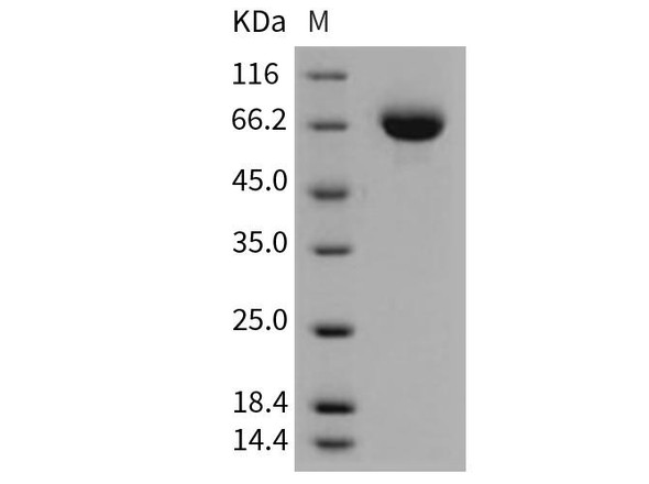 Mouse Endoglin/CD105 Recombinant Protein (RPES2790)